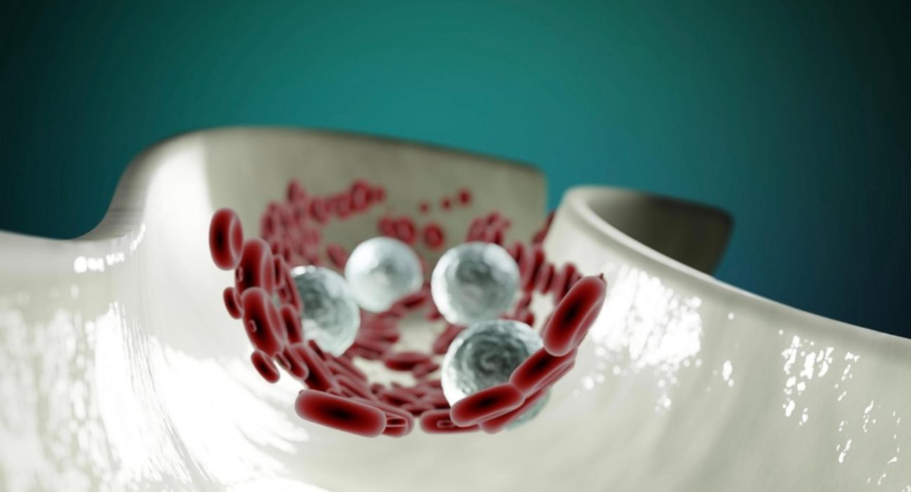 Boala inflamatorie ce afecteaza vasele sanguine