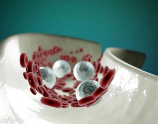 Boala inflamatorie ce afecteaza vasele sanguine