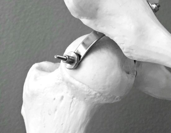 Primele simptome ale osteoporozei si alarmele medicilor