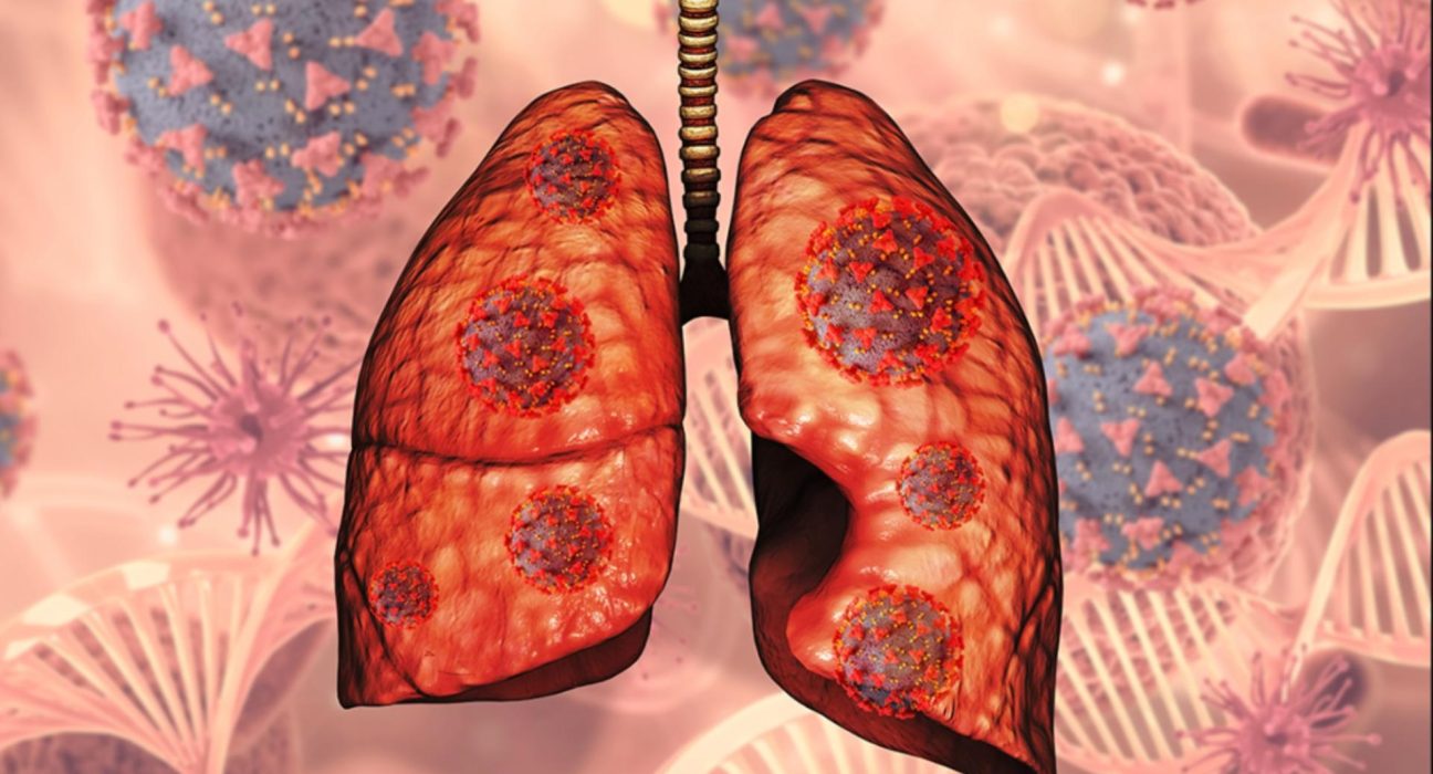 Boala incurabila tuse permanenta si mucus vascos
