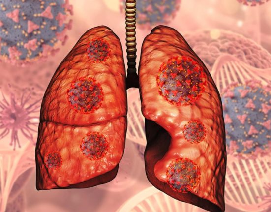 Boala incurabila tuse permanenta si mucus vascos